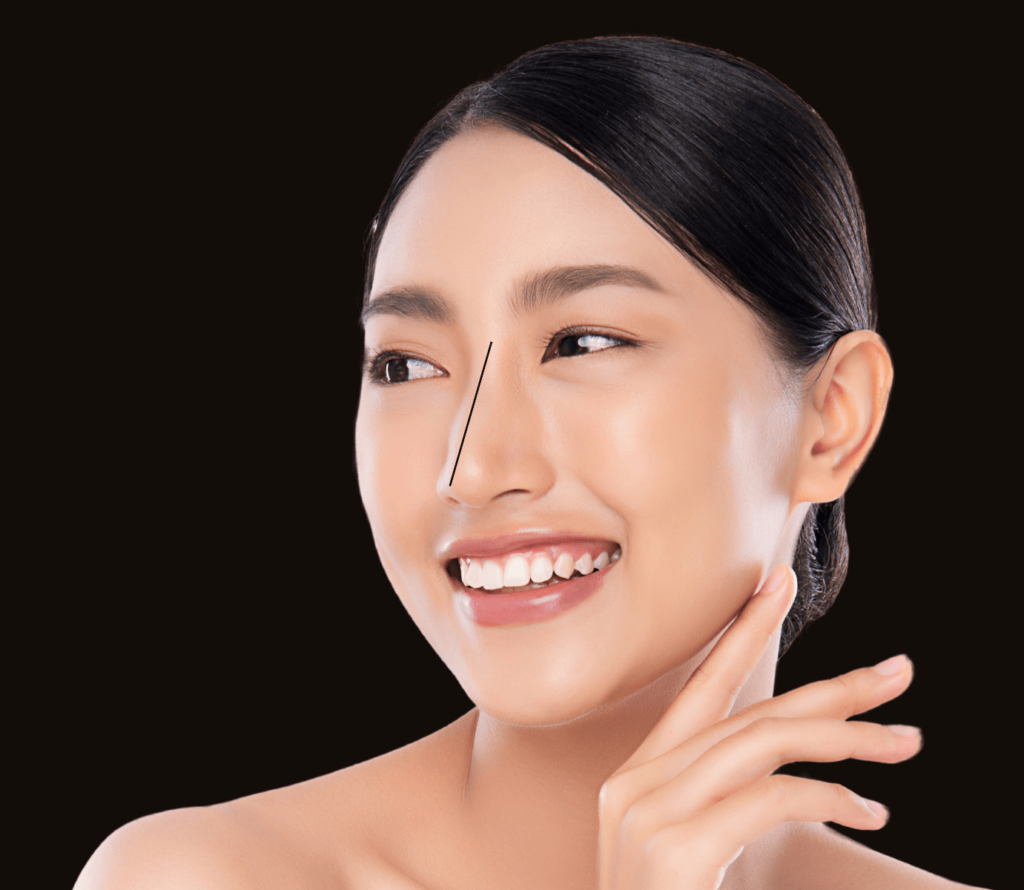 Image Dorsal+augmentation lines