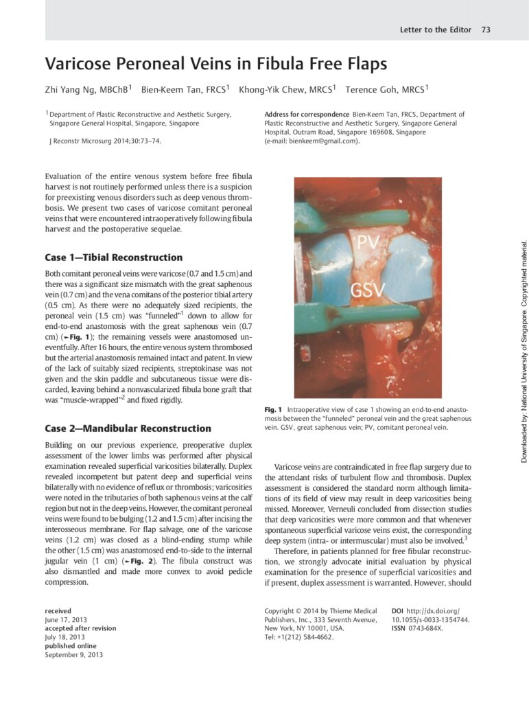 08 Varicose Peroneal Veins in Fibula Flap-1_page-0001