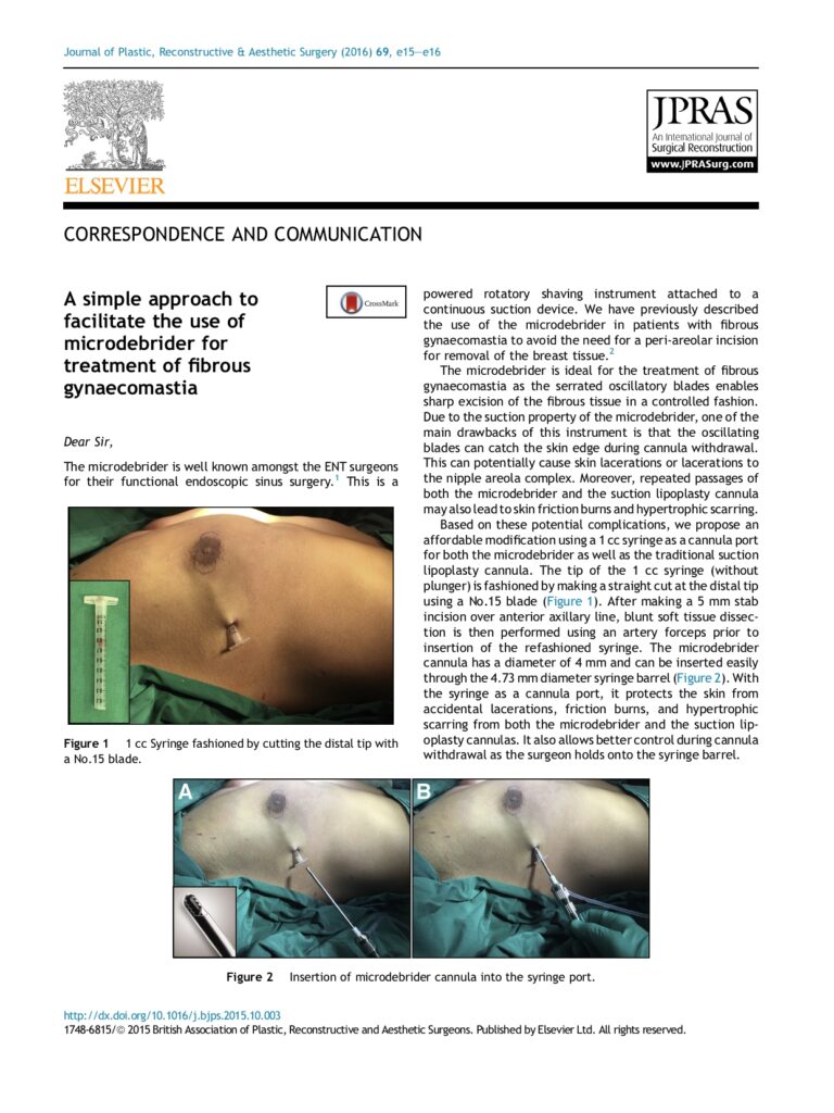 13 A simple approach to facilitate the use of microdebrider for treatment of fibrous gynaecomastia-1_page-0001