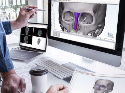 Asian Rhinoplasty &ndash; carousel
