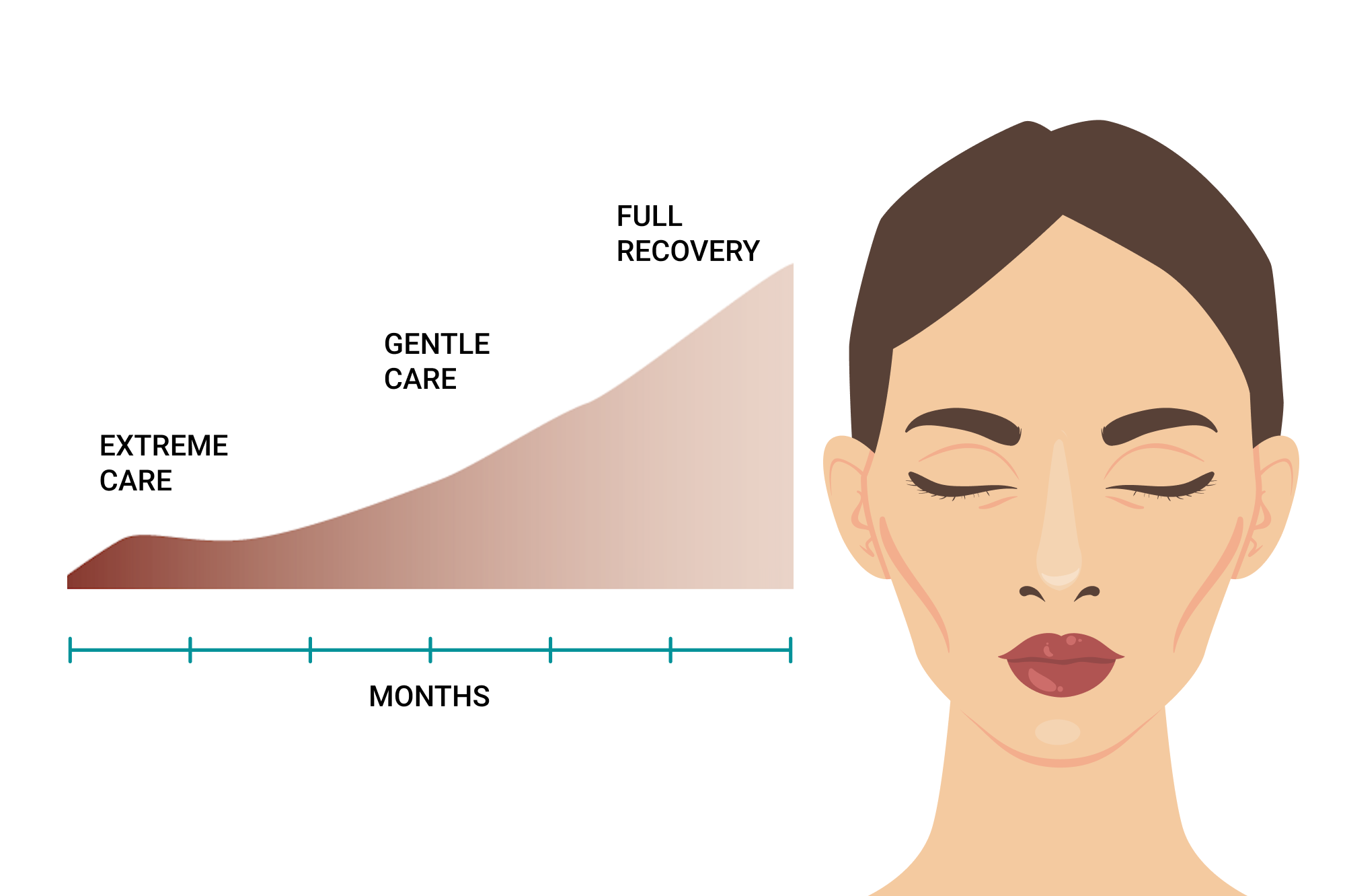 AsianRhinoplasty-ExpectAfter_Healing-Mobile
